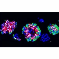 Blood Gas Electrolyte Items